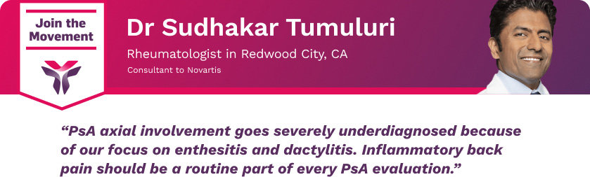 Dr. Sudhakar Tumuluri PSA axial involvement is underdiagnosed