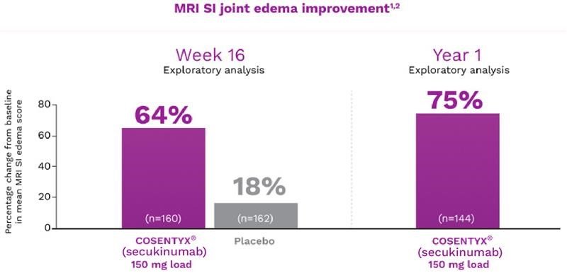 SI Joint Edema Improvement As Seen On MRI