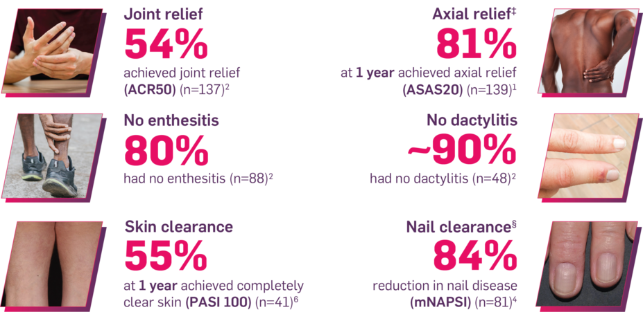 Joint relief: 54% achieved joint relief (ACR50) (n=137); Axial relief: 81% at 1 year achieved axial relief (ASAS20) (n=139); No enthesitis: 80% had no enthesitis (n=88); No dactylitis: ~90% had no dactylitis (n=48); Skin clearance: 55% at 1 year achieved completely clear skin (PASI 100) (n=41); Nail clearance: 84% reduction in nail disease (mNAPSI) (n=81).