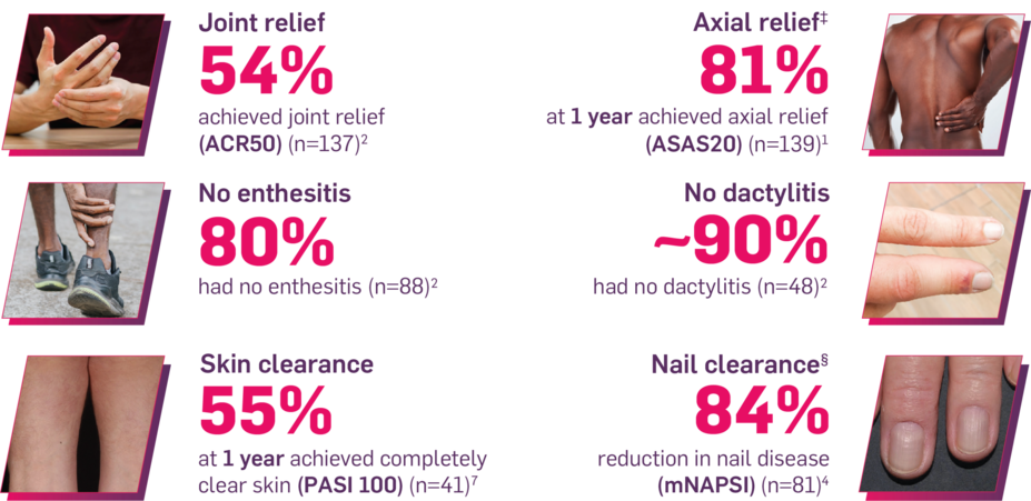 Joint relief: 54% achieved joint relief (ACR50) (n=137); Axial relief: 81% at 1 year achieved axial relief (ASAS20) (n=139); No enthesitis: 80% had no enthesitis (n=88); No dactylitis: ~90% had no dactylitis (n=48); Skin clearance: 55% at 1 year achieved completely clear skin (PASI 100) (n=41); Nail clearance: 84% reduction in nail disease (mNAPSI) (n=81).