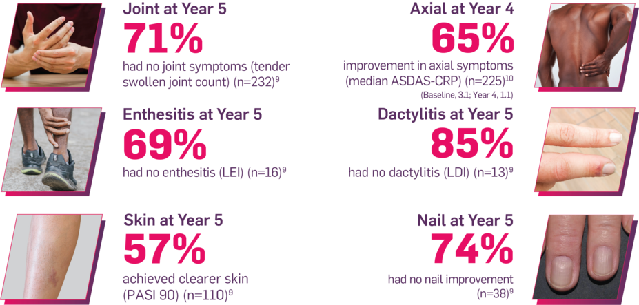 Joint at year 5: 71% had no joint symptoms (tender swollen joint count) (n=232); Axial at Year 4: 65% had improvement in axial symptoms (median ASDAS-CRP) (n=225) (Baseline, 3.1; Year 4, 1.1); Enthesitis at Year 5: 69% had no enthesitis (LEI) (n=16); Dactylitis at Year 5: 85% had no dactylitis (LDI) (n=13); Skin at Year 5: 57% achieved clearer skin (PASI 90)(n=110); Nail at Year 5: 74% had no nail improvement (n=38)