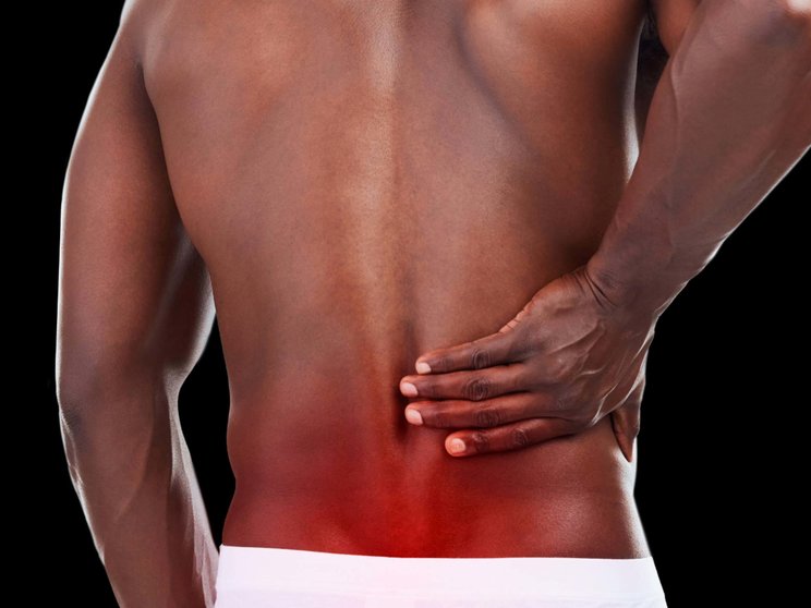 Axial manifestation of PsA